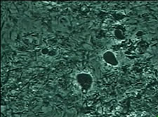 顕微鏡内細菌の写真